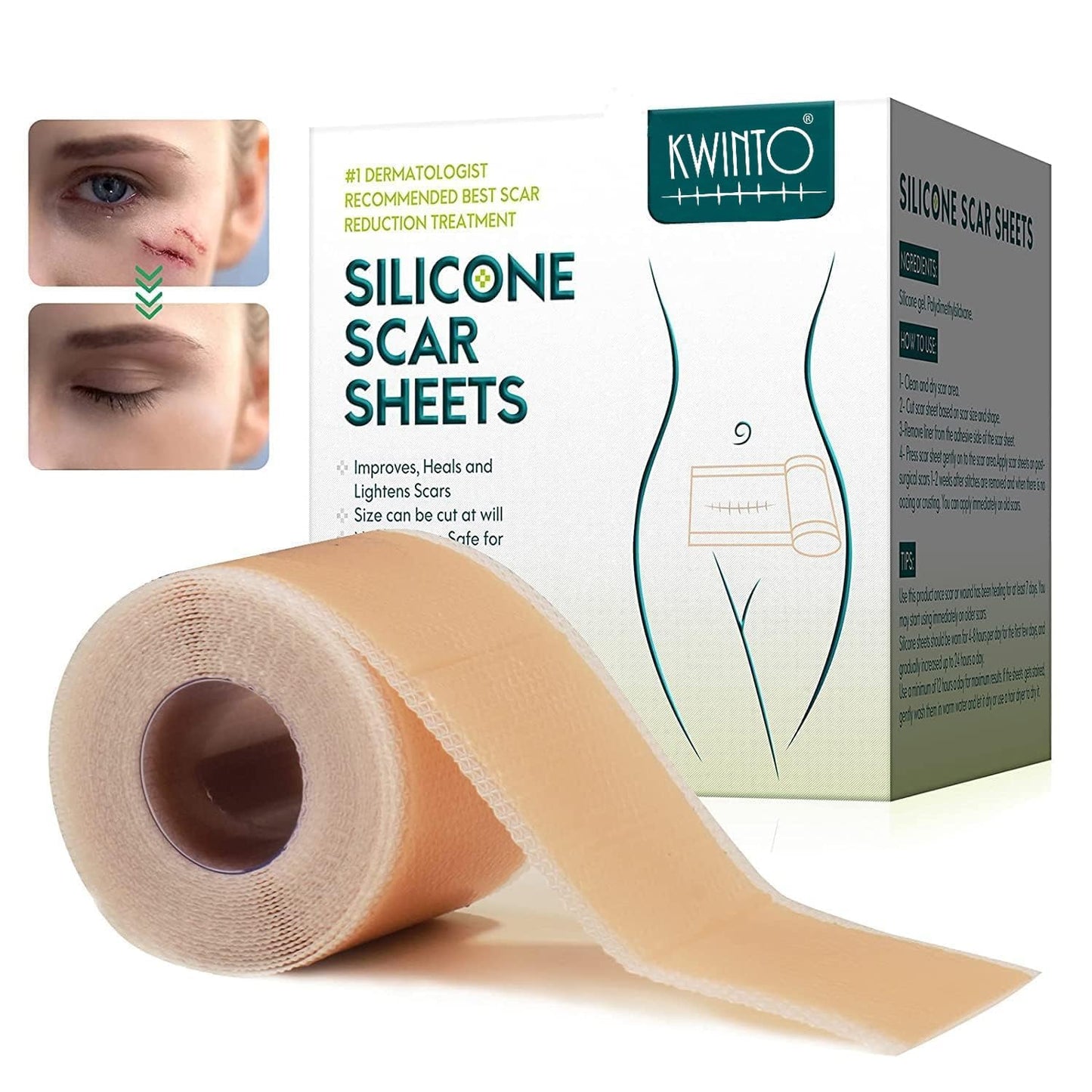 Medical Silicone Gel Sheets – Gentle Scar Reduction Therapy