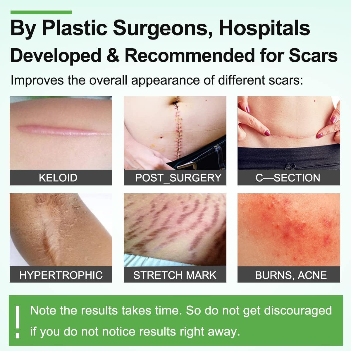Medical Silicone Gel Sheets – Gentle Scar Reduction Therapy