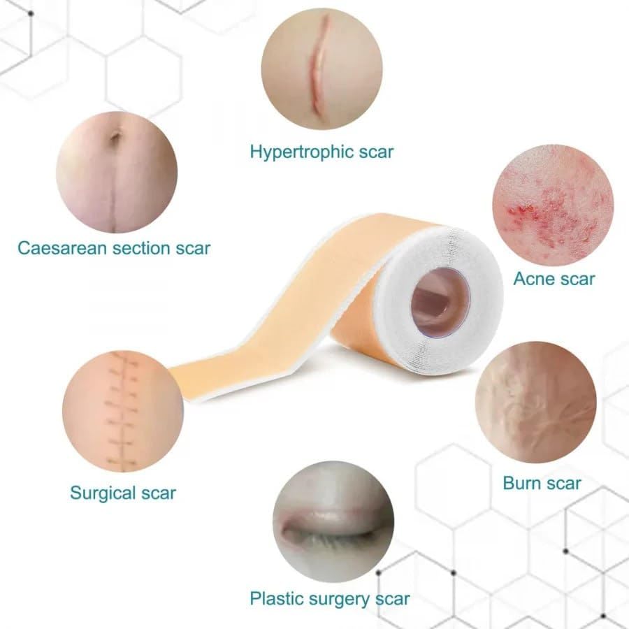 Medical Silicone Gel Sheets – Gentle Scar Reduction Therapy