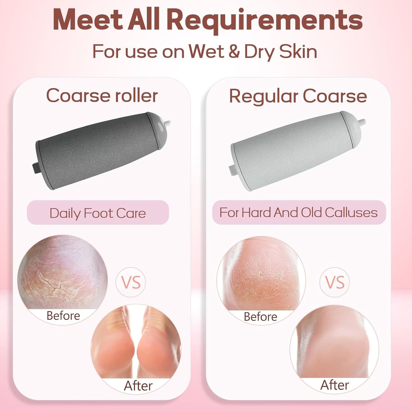 CALLUS AND CORNS REMOVER FOR PERFECT FEET WITHOUT CRACKS AND WITHOUT PAIN