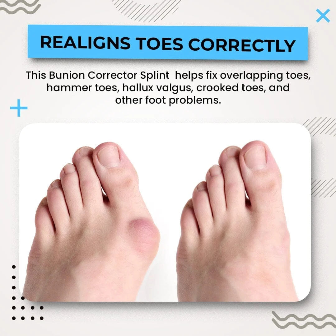 PediAlign™- 3D Bunion Splint Corrector
