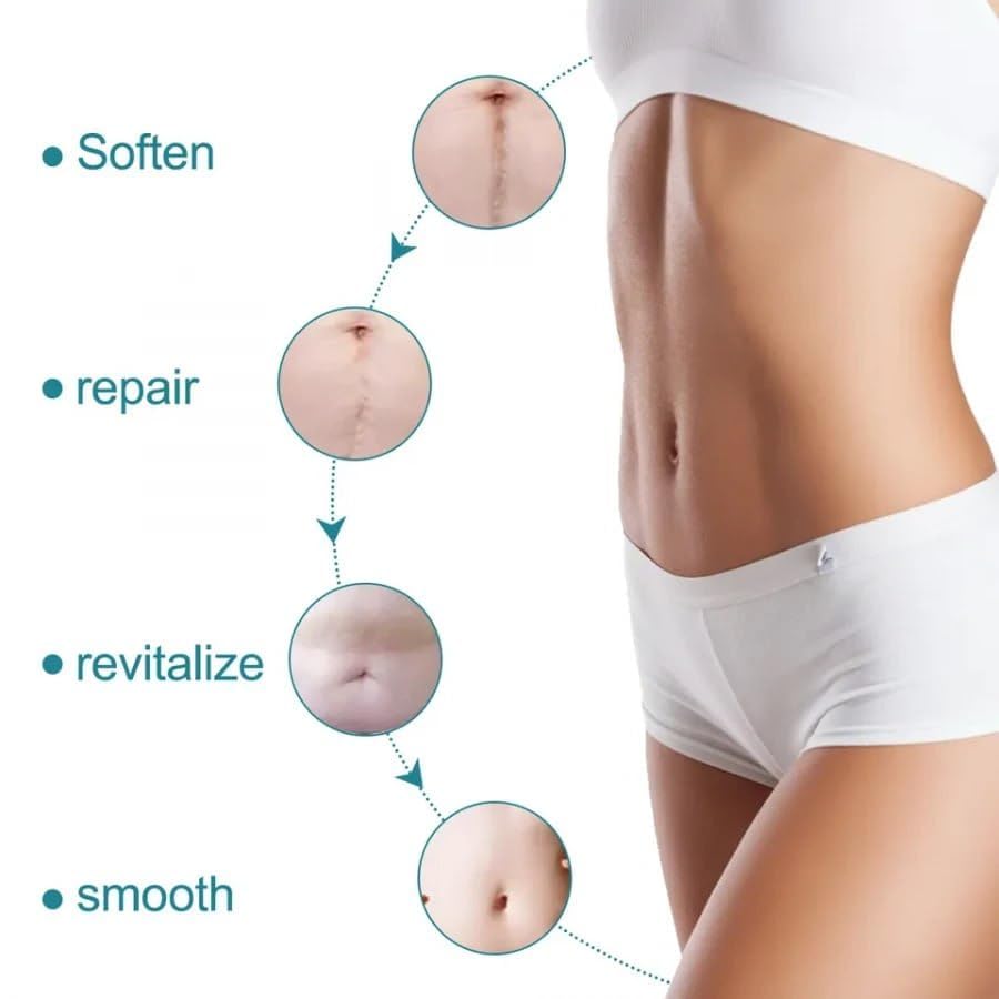 Medical Silicone Gel Sheets – Gentle Scar Reduction Therapy