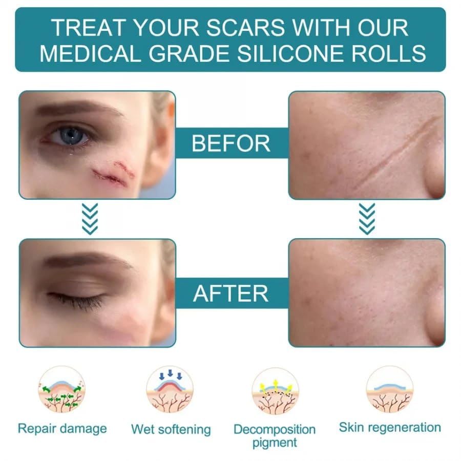 Medical Silicone Gel Sheets – Gentle Scar Reduction Therapy