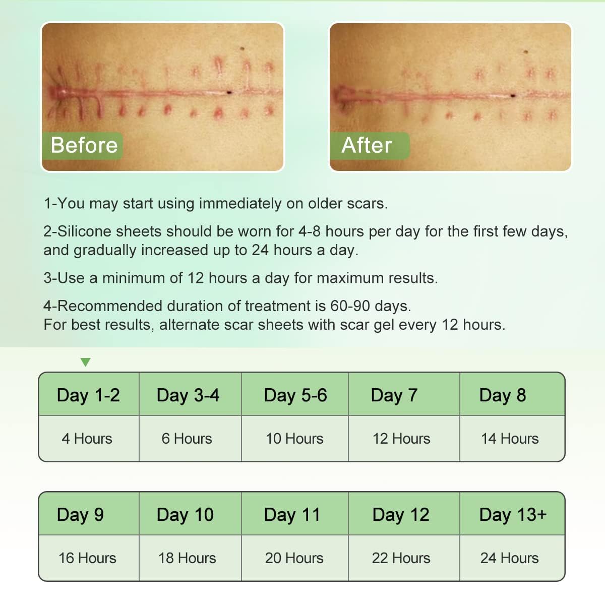Medical Silicone Gel Sheets – Gentle Scar Reduction Therapy