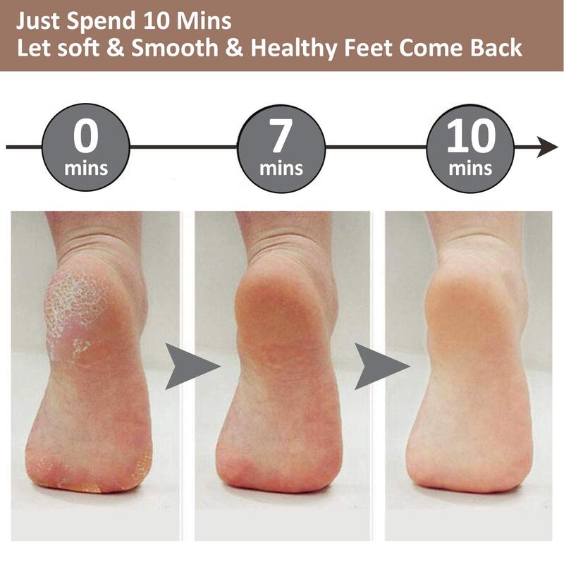 Rechargeable Electric Foot Callus Remover