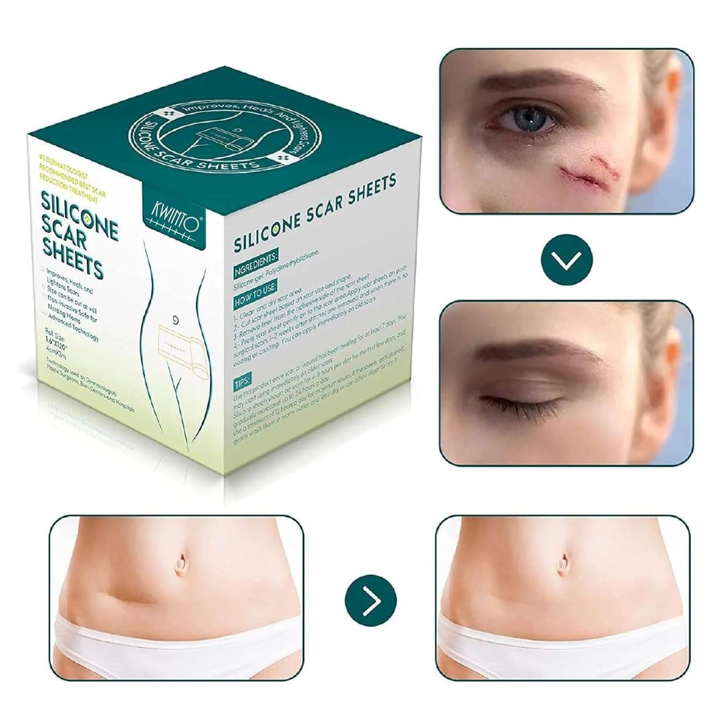 Medical Silicone Gel Sheets – Gentle Scar Reduction Therapy