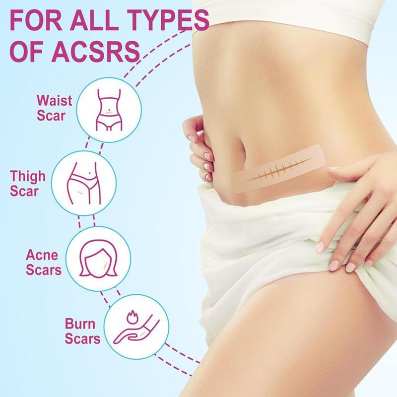 Medical Silicone Gel Sheets – Gentle Scar Reduction Therapy