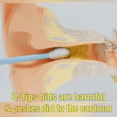 The Most Professional Ear Cleaning Master In 2024—EarWax Cleaner Tool – TheWishCrate