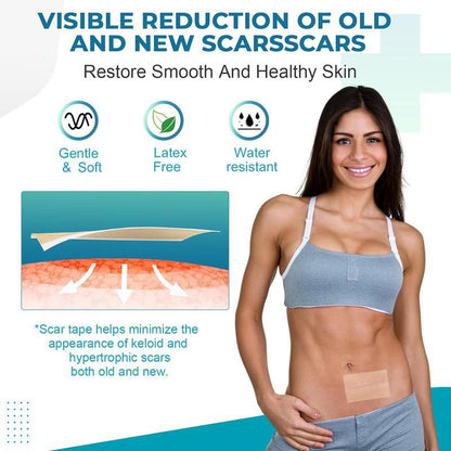 Medical Silicone Gel Sheets – Gentle Scar Reduction Therapy