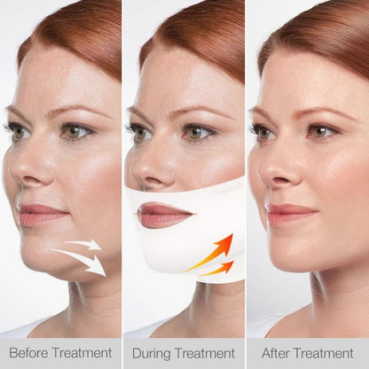 Double Chin Reducing V Shape Face Slimming Mask